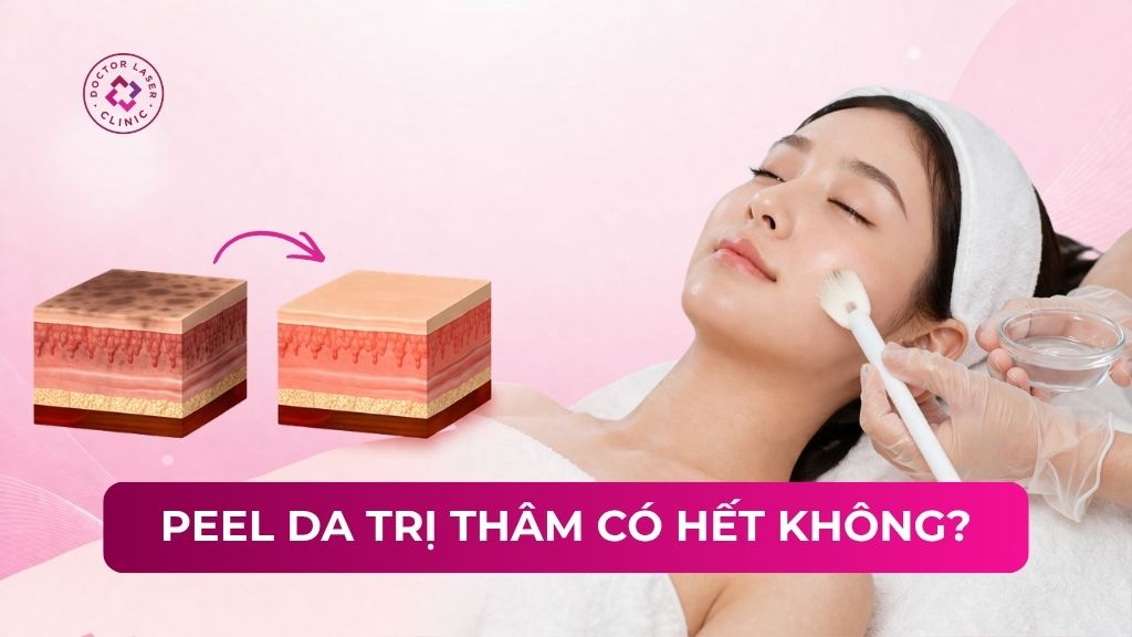 Peel da trị thâm có hết không? Phân loại và quy trình thực hiện