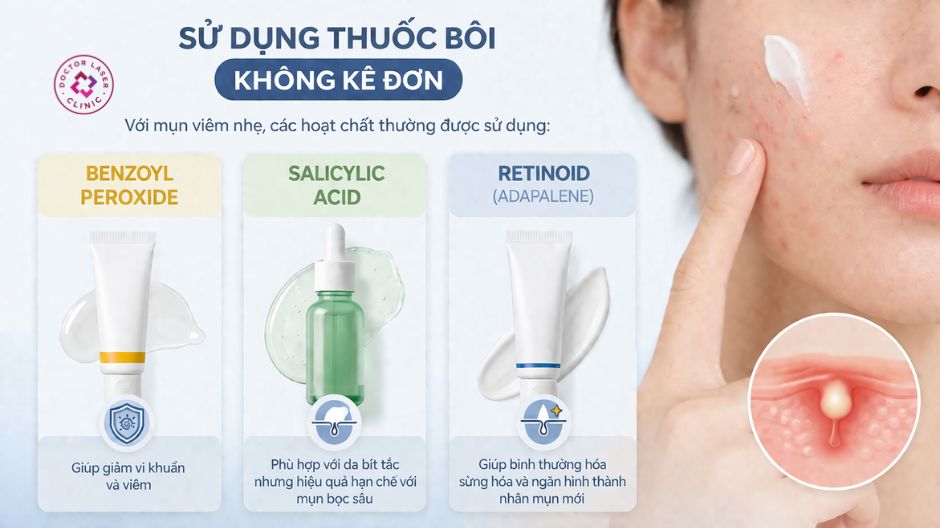 sử dụng thuốc bôi không kê đơn trị mụn bọc má