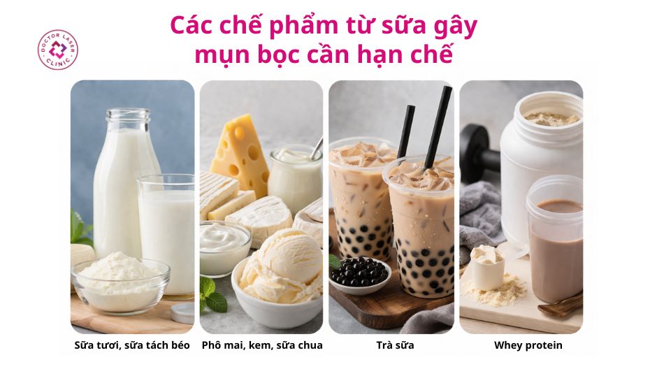 sữa và chế phẩm từ sữa gây mụn bọc