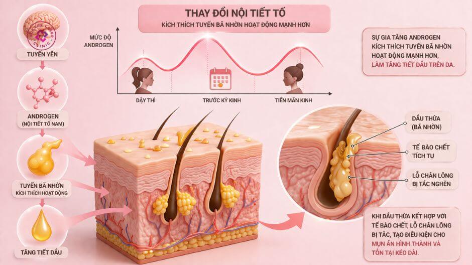 thay đổi nội tiết tố gây mụn ẩn ở lưng