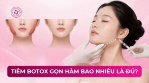tiêm botox gọn hàm bao nhiêu là đủ