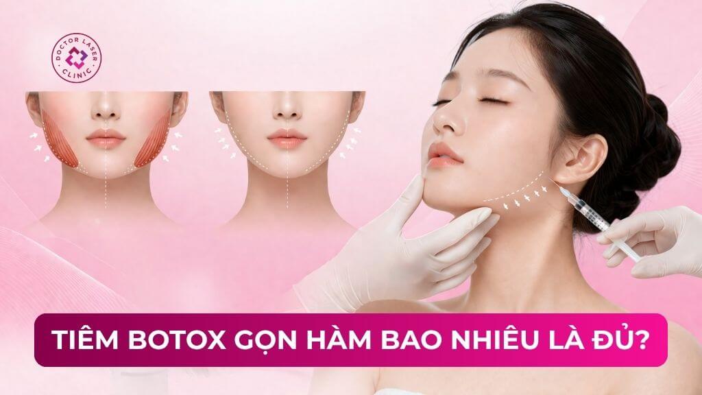 Tiêm botox gọn hàm bao nhiêu cc là đủ và an toàn?