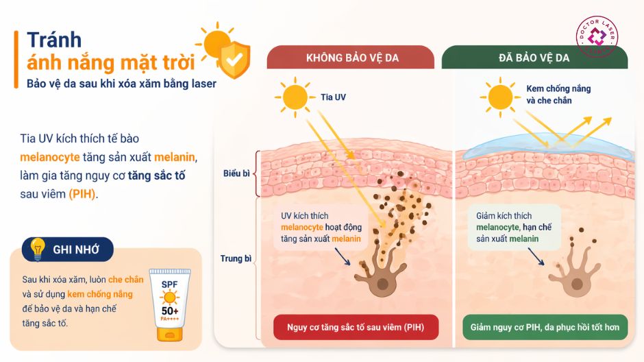 tránh ánh nắng mặt trời sau xoá xăm