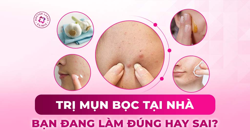 Đánh giá 8 cách trị mụn bọc tại nhà theo góc nhìn y khoa