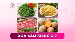xoá xăm kiêng gì