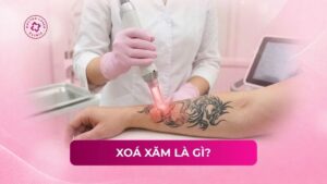 xoá xăm là gì