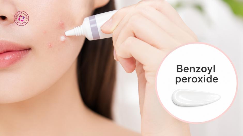benzoyl peroxide trị mụn đầu trắng