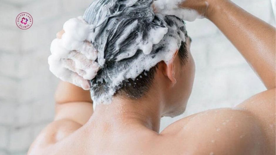gội đầu không sạch tóc bết dầu gây mụn ở thái dương