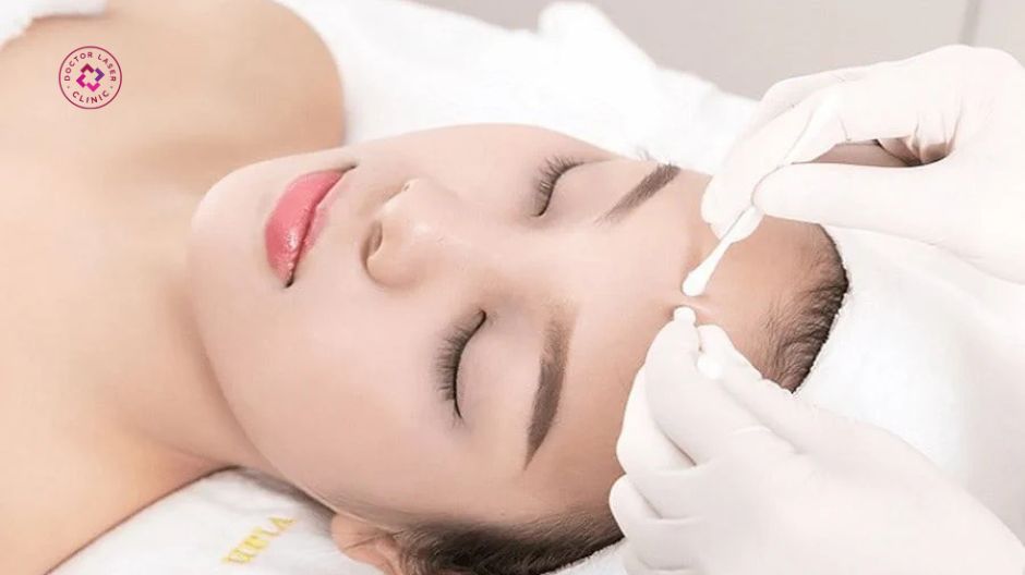 nặn mụn có tốt không