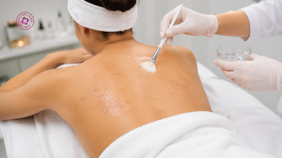 peel lưng hỗ trợ trẻ hoá da