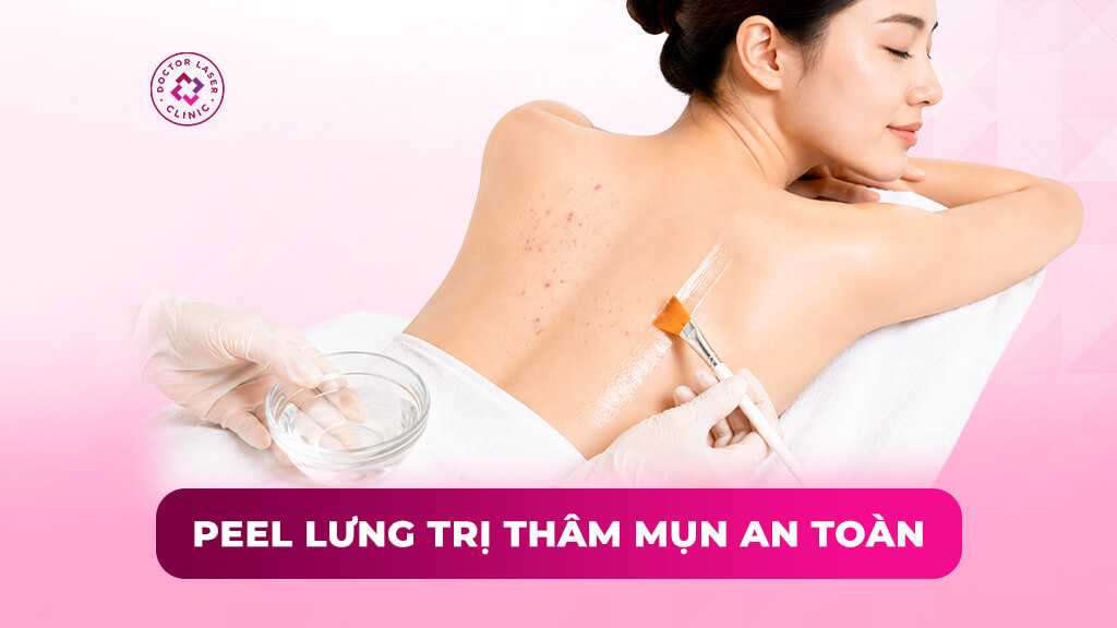Peel lưng trị thâm mụn hiệu quả và an toàn