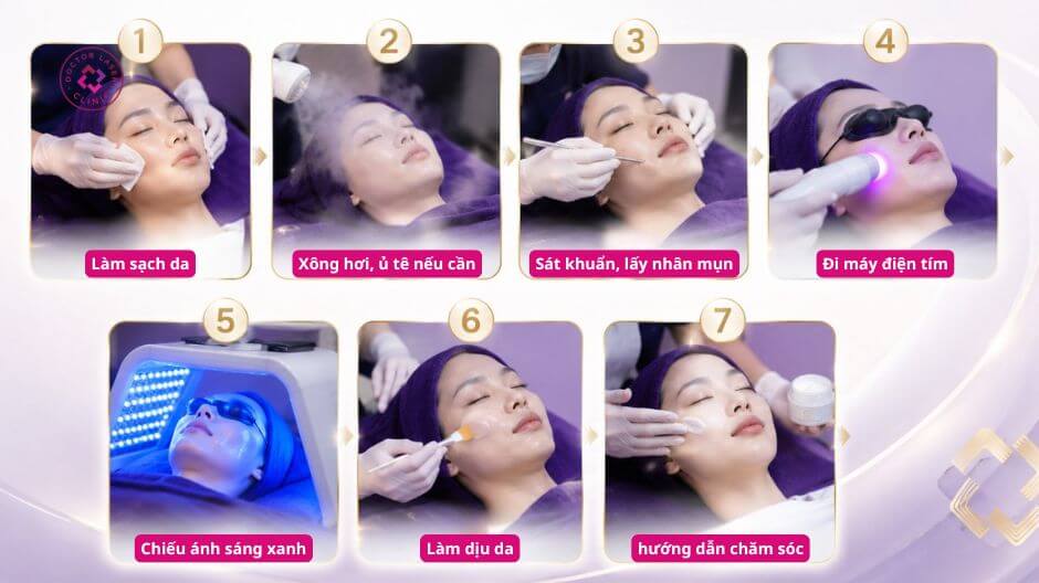 quy trình nặn mụn theo tiêu chuẩn y khoa