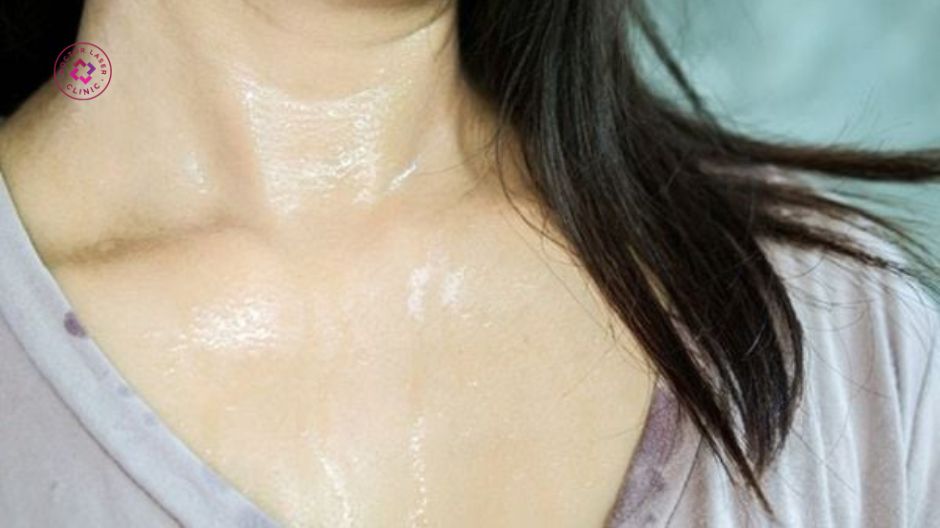 tăng tiết mồ hôi gây mụn ở ngực