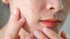 tiêm prp có làm da khoẻ từ bên trong thật không hay chỉ căng bóng tạm thời