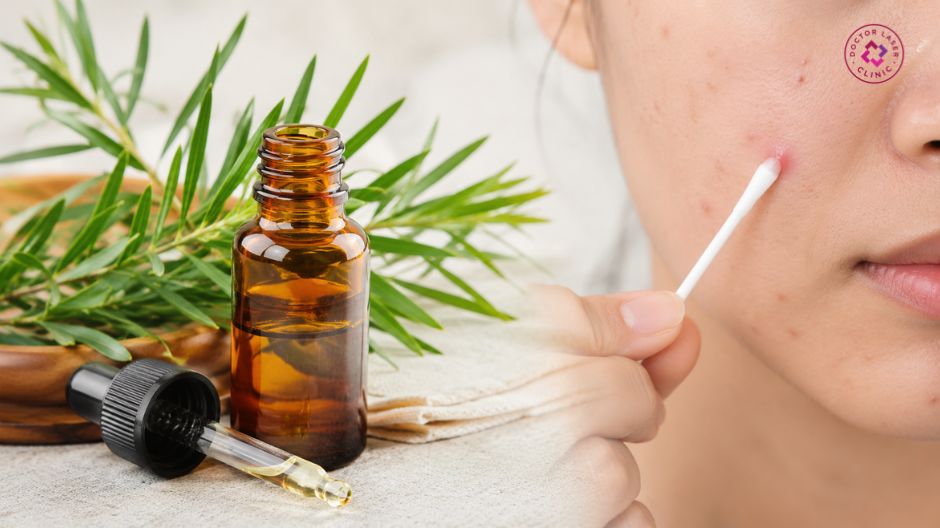 tinh dầu tràm trà trị mụn tại nhà