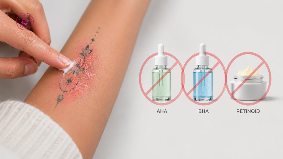 tránh aha bha retinoid sau xóa xăm