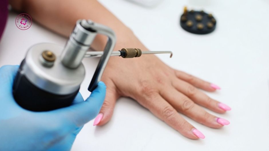 áp lạnh điều trị sẹo lồi