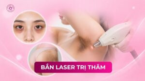 bắn laser trị thâm