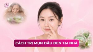 cách trị mụn đầu đen tại nhà
