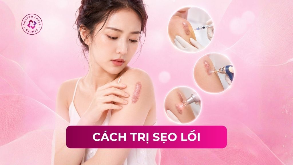 5 cách trị sẹo lồi hiệu quả và an toàn theo bác sĩ da liễu