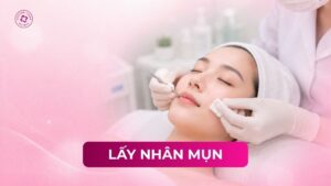 lấy nhân mụn