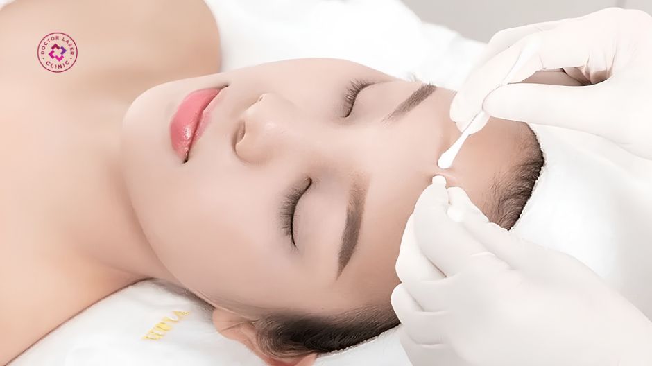 lấy nhân mụn là gì