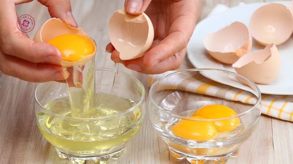 lòng trắng trứng gà khi bị mụn đầu đen