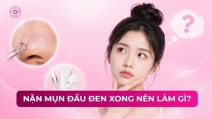 nặn mụn đầu đen xong nên làm gì