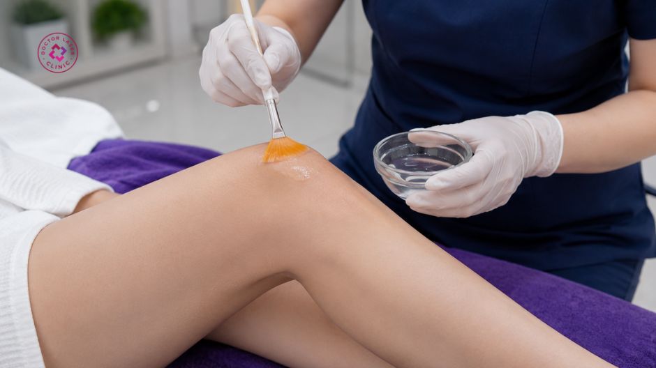 peel da body cấp độ nhẹ