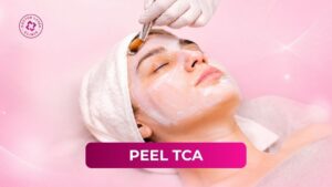 peel tca