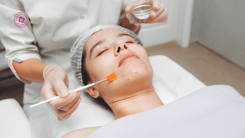 peel tca trẻ hóa da xoá mờ nếp nhăn