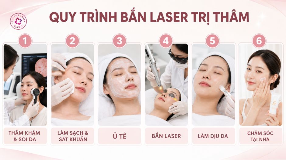 quy trình bắn laser trị thâm chuẩn y khoa