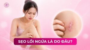 sẹo lồi ngứa là do đâu sẹo lồi ngứa là do đâu