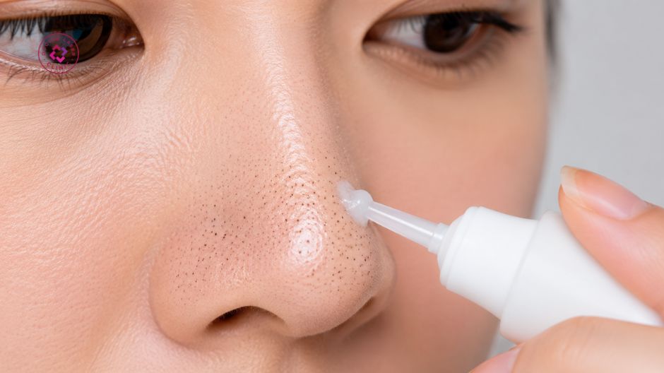 thuốc bôi điều trị mụn đầu đen