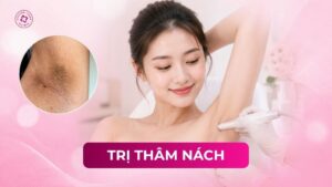 trị thâm nách