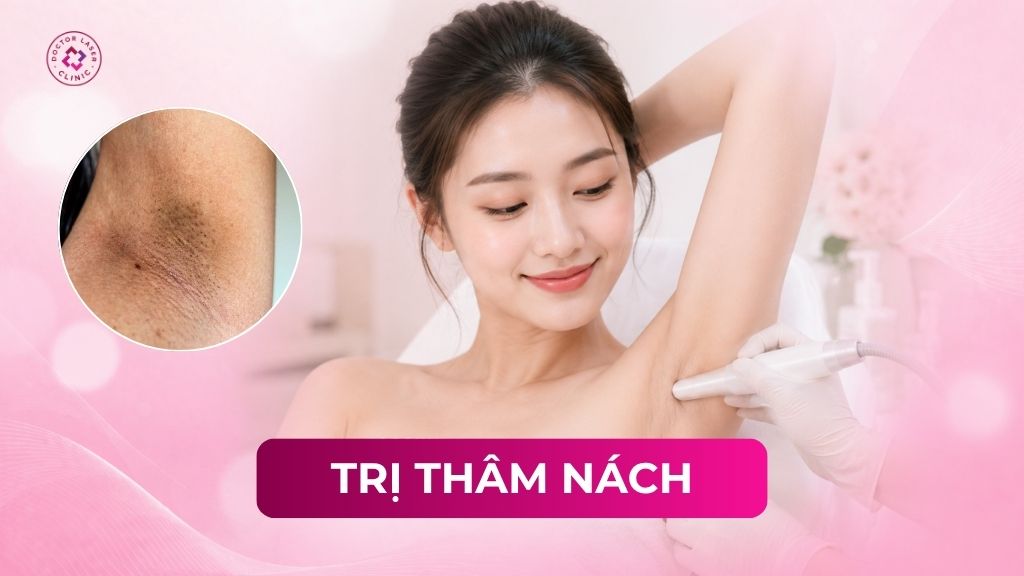 Các phương pháp trị thâm nách hiệu quả hiện nay