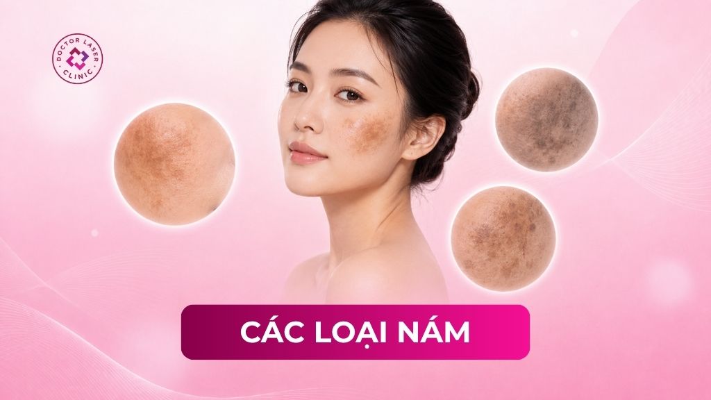 Phân biệt các loại nám da: Vị trí và hình ảnh nhận diện