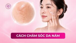 cách chăm sóc da nám
