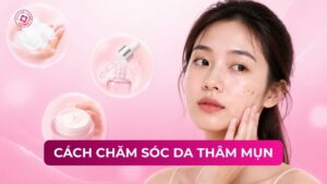 cách chăm sóc da thâm mụn