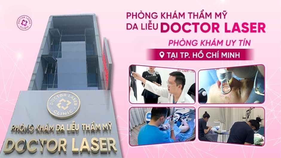 dịch vụ laser trị nám tại doctor laser