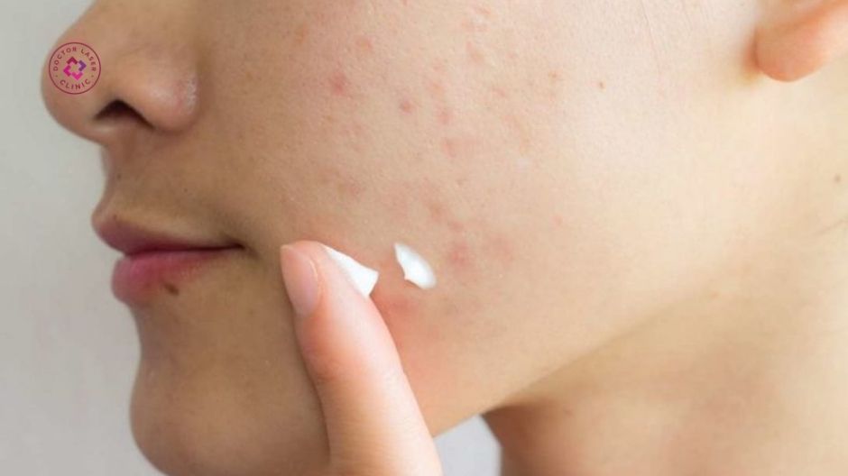 dược mỹ phẩm bôi thoa trị thâm mụn