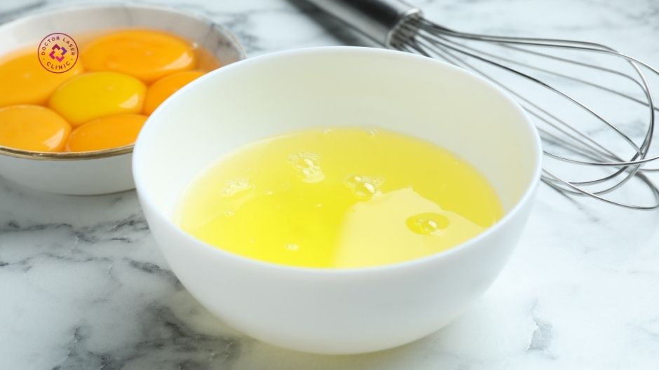 lòng trắng trứng gà có gây sẹo lồi không