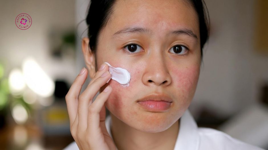 lựa chọn hoạt chất chăm sóc da mụn và thâm