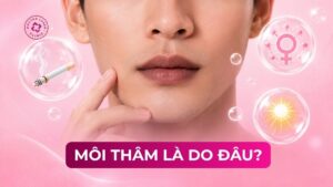môi thâm là do đâu