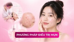 phương pháp điều trị mụn