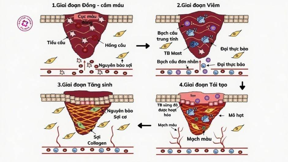quá trình hình thành của sẹo