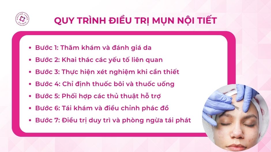 quy trình điều trị mụn nội tiết