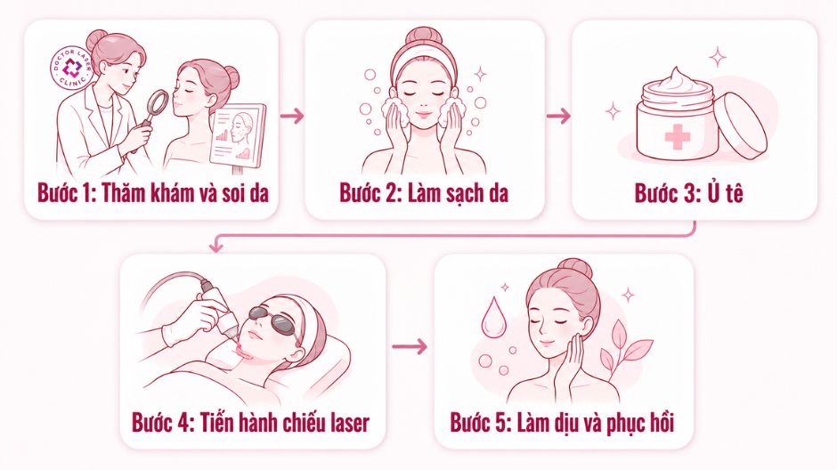 quy trình điều trị thâm mụn bằng laser chuẩn y khoa