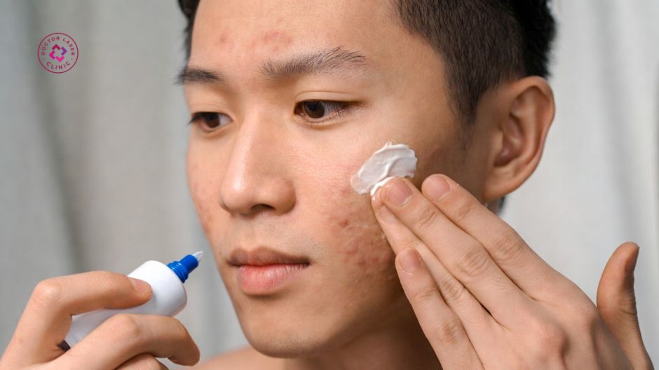 sản phẩm đặc trị hỗ trợ thâm mụn