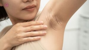 sau peel bao lâu thì có thể dùng lăn khử mùi